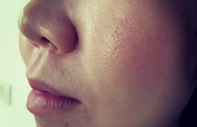 アラサー女子が直面 お肌の曲がり角を実感した5つのこと 女子力アップcafe Googirl